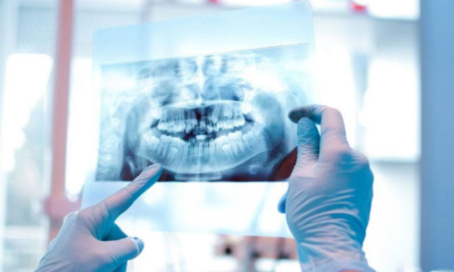 Cirugía Oral y Maxilofacial