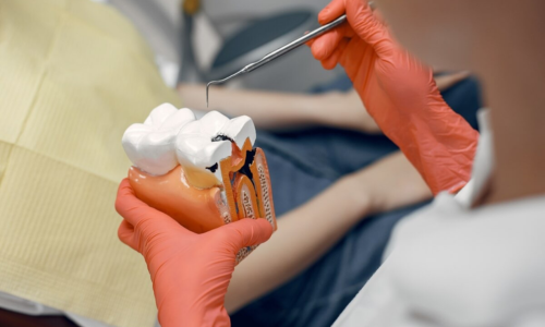 Endodoncia